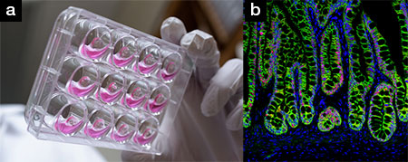 Hydrogel grows organ