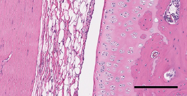 cartilage regeneration - see caption